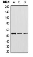 CDK8 Antibody (N-Terminus)
