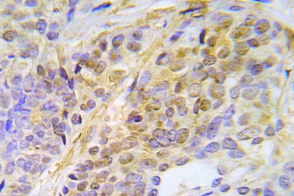 CHEK2 / CHK2 Antibody (phospho-Thr387)