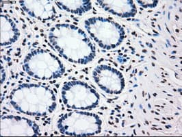 PLK1 / PLK-1 Antibody (clone OTI1D4)