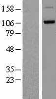 DDHD1 Protein (Over-Expression Lysate Myc-DDK (Flag))