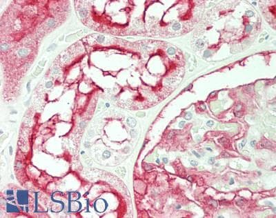 PathPlus™ MME / CD10 Antibody (clone 56C6)