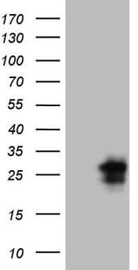 CTLA4 / CD152 Antibody (clone OTI8D12)
