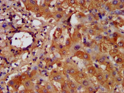 HAL / Histidine Ammonium Lyase Antibody