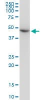 IHC-plus™ TUBB2A / Tubulin Beta 2A Antibody (clone 2B2)