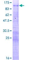 Human MBD1 Protein (Recombinant GST)