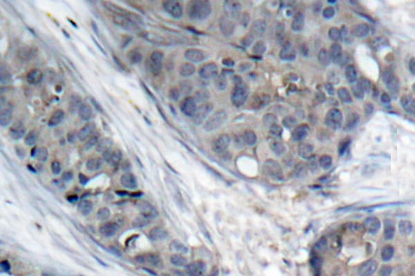 IRS1 Antibody (phospho-Ser307)