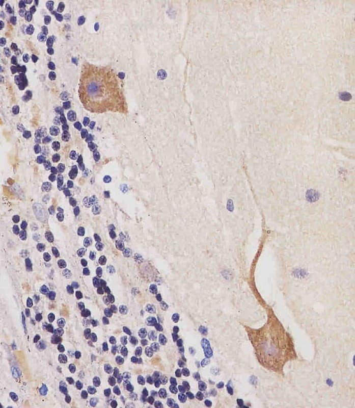 CAMK2B / CaMKII Beta Antibody (C-Terminus, clone 1050CT14.1.3)