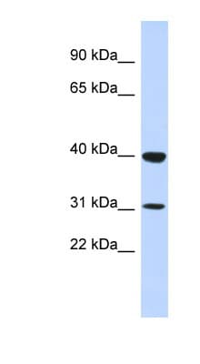 Polyclonal Rabbit anti-Human ZNF660 Antibody (N-Terminus, WB)