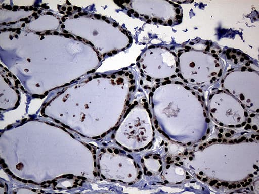 ASH2L / ASH2 Antibody (aa347-628, clone OTI7D11)