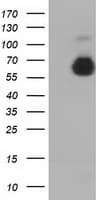 PathPlus™ Alpha-Fetoprotein Antibody (clone OTI2E2)