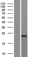 Human EPPIN-WFDC6 Protein (Over-Expression Lysate Myc-DDK (Flag))