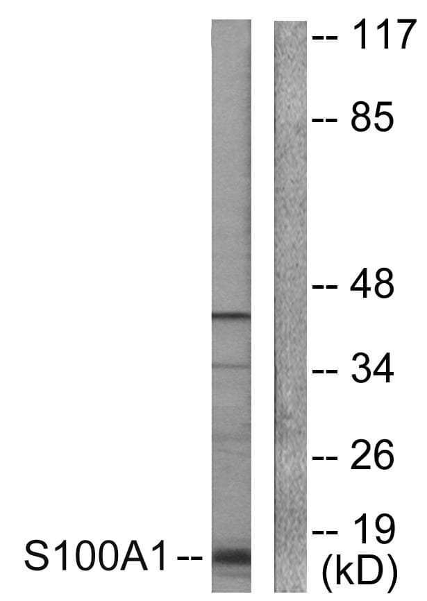 Polyclonal Rabbit anti-Human S100 Protein Antibody (IHC, IF, WB)