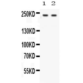 OTOF / Otoferlin Antibody (aa1831-1863)