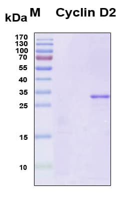 Human CCND2 / Cyclin D2 Protein (Recombinant 6His, N-terminus)