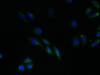 Polyclonal Rabbit anti-Human RNF183 Antibody (IHC)
