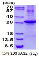 Human KLK7 / Kallikrein 7 Protein (Recombinant His)