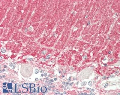 SYN1 / Synapsin 1 Antibody (HRP)