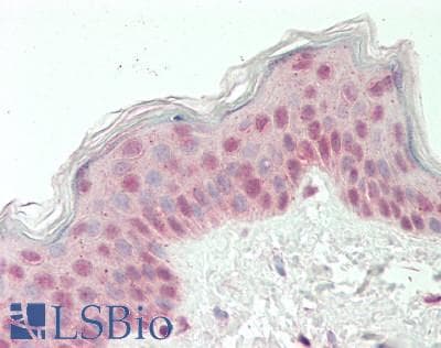 RARG / RAR-Gamma Antibody (aa36-85)