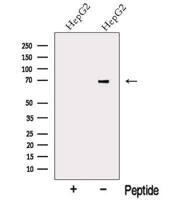 Polyclonal Rabbit anti-Human KIAA0391 Antibody (WB)