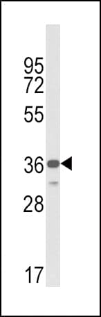 IHC-plus™ MICA Antibody (aa68-97)