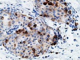 Monoclonal Mouse anti-Human CD80 Antibody (clone OTI2E5, IHC, IF, WB)