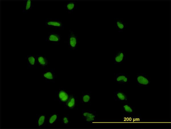 IHC-plus™ CCNH / Cyclin H Antibody (clone 1B8)