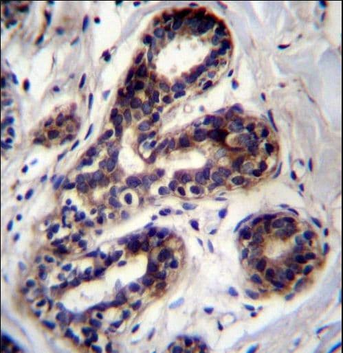 Polyclonal Rabbit anti-Human PCCA Antibody (aa362-390, IHC, WB)