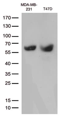 MMP11 Antibody (aa239-488, clone OTI3E10)