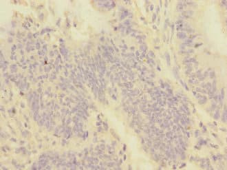 PMPCA Antibody