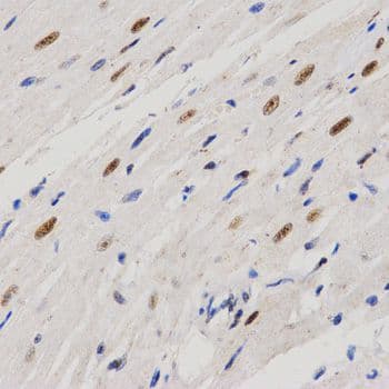 Polyclonal Rabbit anti-Human PELP1 Antibody (IHC)