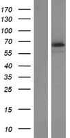 TCTN1 Protein (Over-Expression Lysate Myc-DDK (Flag))