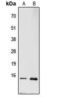 Polyclonal Rabbit anti-Human RPL22 / Ribosomal Protein L22 Antibody (Internal, WB)
