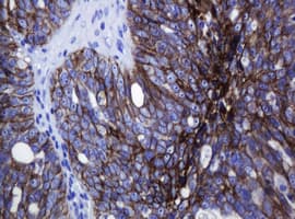 Monoclonal Mouse anti-Human CDH1 / E Cadherin Antibody (clone OTI2F9, IHC, WB)