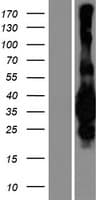 MED29 / IXL Protein (Over-Expression Lysate Myc-DDK (Flag))
