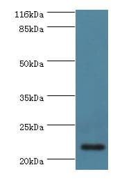 Complement C8g Antibody (aa21-202, FITC)