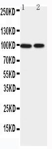 EPB41L1 / 4.1N Antibody (aa585-604)