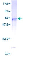 Human UCK2 Protein (Recombinant GST)