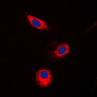 AKR1B1 / Aldose Reductase Antibody (C-Terminus)