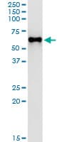 MPP1 Antibody (clone 1E11-1G11)