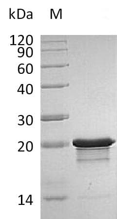Human FGF8 Protein (Recombinant)