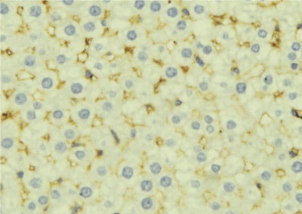 CFH / Complement Factor H Antibody
