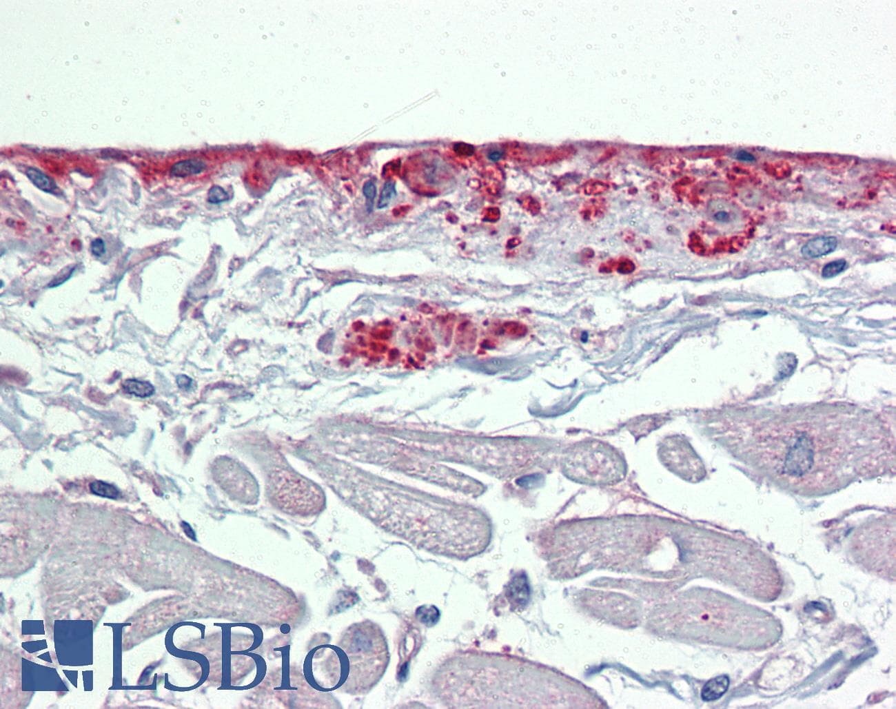POSTN / Periostin Antibody (C-Terminus)
