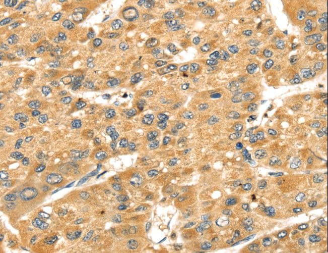 SH3KBP1 / CIN85 Antibody