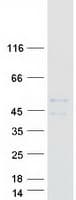 Human TMEM151A Protein (Recombinant Myc-DDK (Flag))