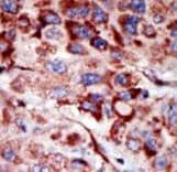 AK2 / Adenylate Kinase 2 Antibody (aa187-217)