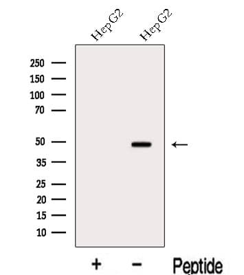 Polyclonal Rabbit anti-Human MAT2A Antibody (WB)