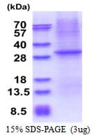 Human CD1E Protein (Recombinant His)