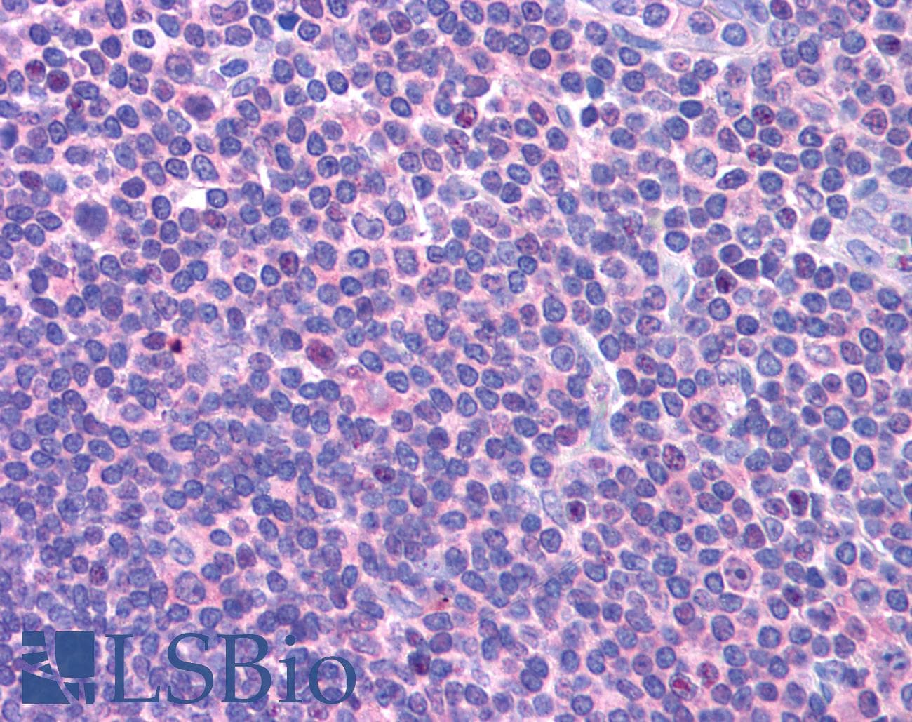 IHC-plus™ DCLRE1C / Artemis Antibody (Internal)