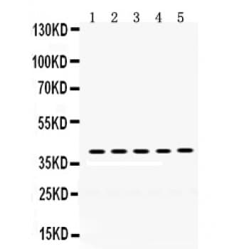 OSM / Oncostatin M Antibody (aa26-220)