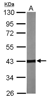 Polyclonal Rabbit anti-Human TBCC Antibody (aa52-306, WB)